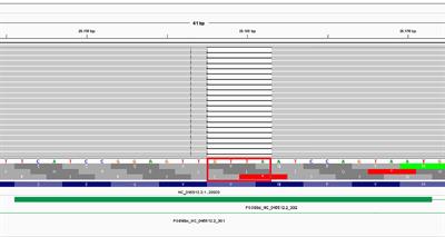 Case Report: Discovery a Novel SARS-CoV-2 Variant in a Six-Months Long-Term Swab Positive Female Suffering From Non-Hodgkin Lymphoma